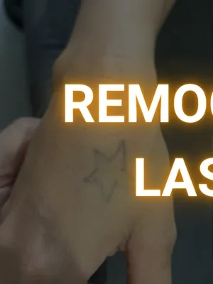 Capa_Remoção_Mobile_1