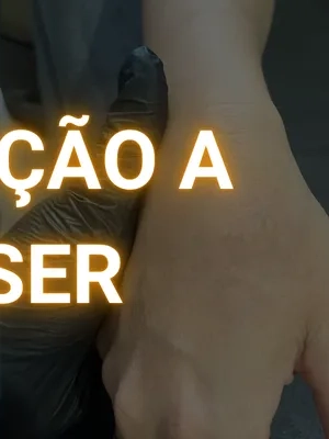 Capa_Remoção_Mobile_2